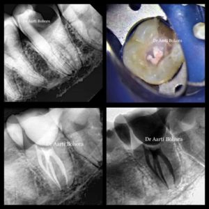 142. Cactus ario hybr (fiss x ret) (grafted) - AbuMaizar Dental Roots Clinic